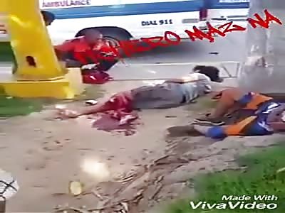 Lose the leg in accident