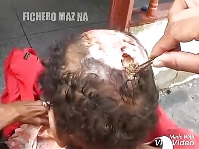 Worms eat the head of this man