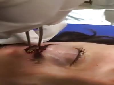 Woman with bullet in the eyebrow