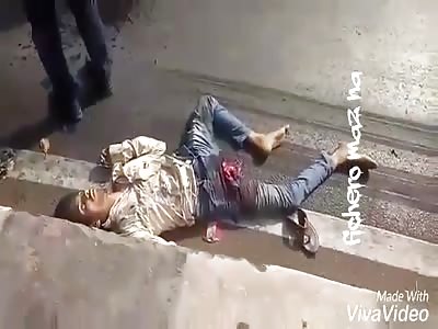 Aftermath of a motorcycle accident