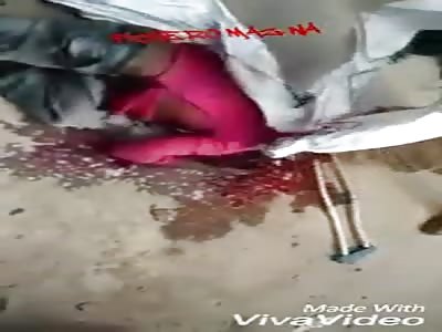 Man with head shattered