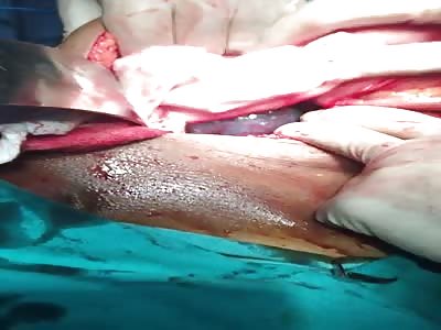 They take the testicles by the belly