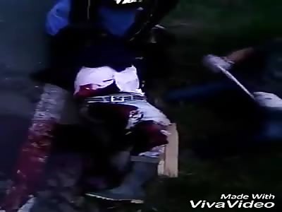 Man screams in pain after accident  (1)