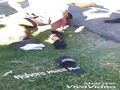 Broken ankle in accident