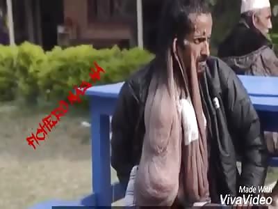 His face falls from shame