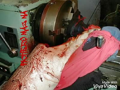 Lathe machine crushes head of man
