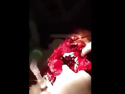 Man with shattered face