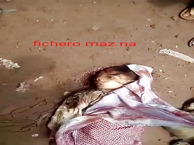 His head was crushed