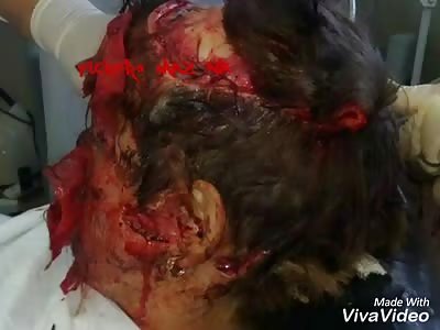 French tourist attacked by bear in Russia