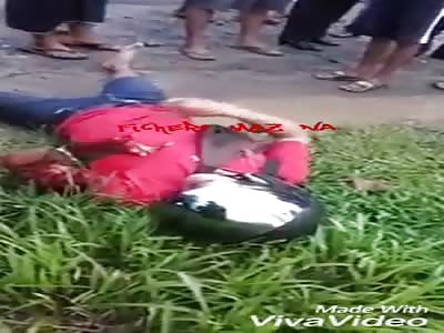 Man loses hand in accident (you can not touch two boobs you see)