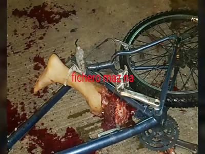 Man flies his leg with homemade bomb