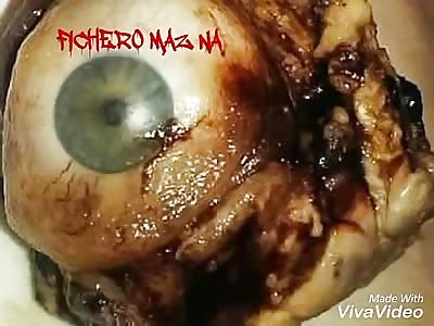 A lot of eye with the video