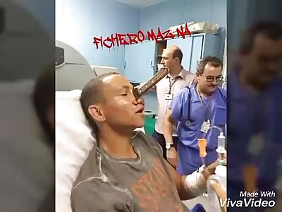  Man with knife in the face