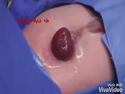 (Shocking) very sad has the heart out