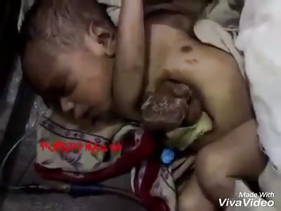 (Shocking) very sad the heart out of his body