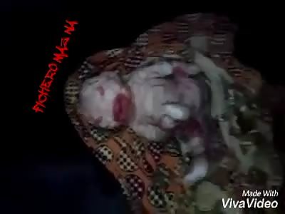 (Shocking) very sad born with reptile skin