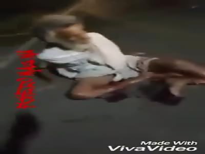 Poor Old Man with Horrific Exposed Fracture on the Road Needs Help