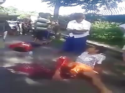 Terrible accident man with the miserable leg