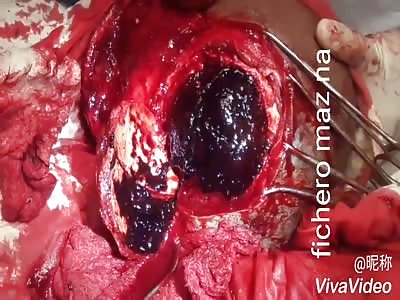 Taking jam for breakfast