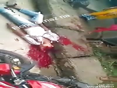 Shocking: MAN WITH DESTROYED HEAD (Still Alive)