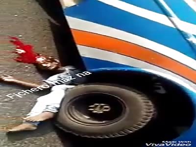 ACCIDENT :man loses his leg