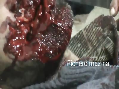 man has his mouth shattered for sure he wanted to be the joker