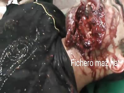 man has mouth like the joker