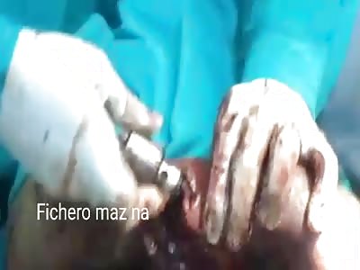 drill in the arm that's modern medicine