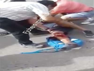 man screams in pain when he sees his knee broken