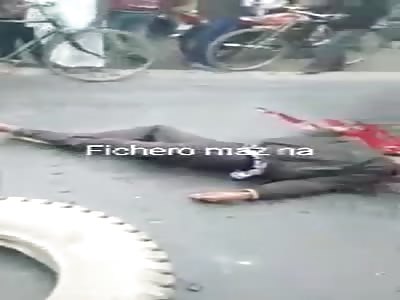 man with flattened head