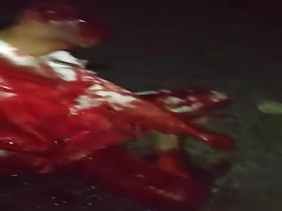 TERRIBLE SEQUELS OF THE ACCIDENT