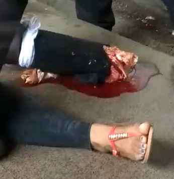 Woman is calm with a foot missing