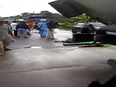 MAN SUFFERS THE LOSS OF HIS FEET