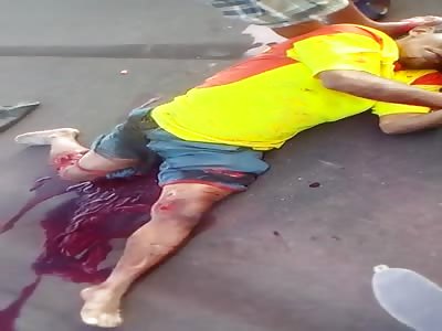 OLD MAN SUFFER ACCIDENT