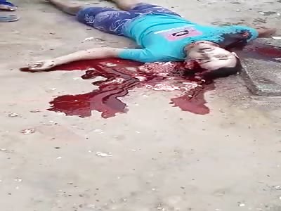 Gruesome Murder Scene of a Man with Brains Seeping out his Head 