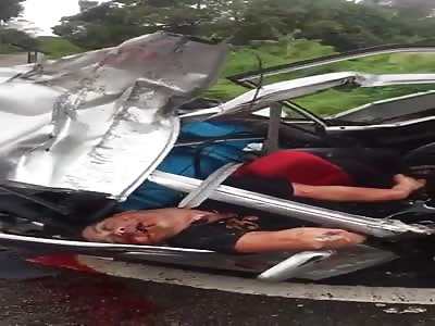 Man's Face Unrecognizable After Terrible Accident