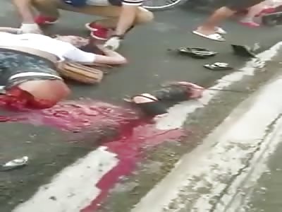 Woman with Severed Shocking Leg Trauma 