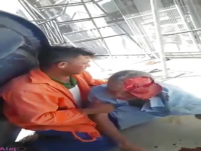 Old Man Was Horribly Scalped after Work Accident