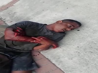 Thief Shot Dead, One Badly Wounded in Brazil