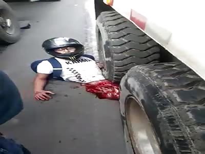 Man Still Alive After Being Cut in Half by Truck