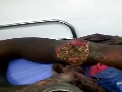 WTF ðŸ¤®ðŸ¤®ðŸ¤¢ðŸ¤¢