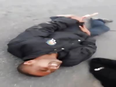 Thief with Snapped Femur Sticking Out after Escape from Police