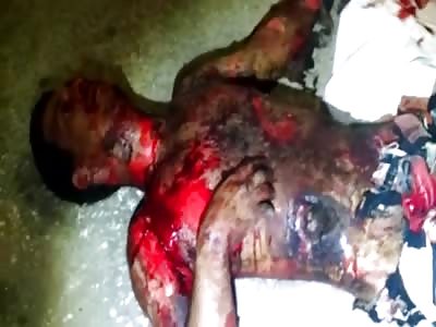 Kidnapper that was Burned ...Still Alive 