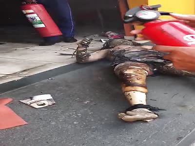 Skin Peels Off Burn Victims