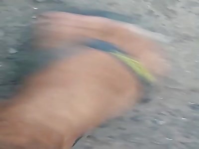 man agonizing after receive shots