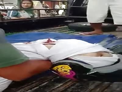 ACCIDENT OF MOTORCYCLIST