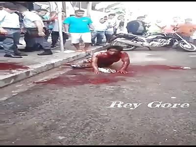 Brutal Machete Attack Leaves Them Mangled...