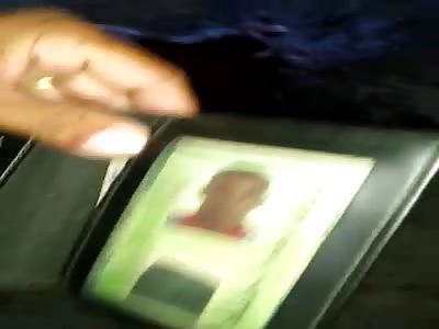 Unrecognizable Facial Features After Gang Attack in Brazil