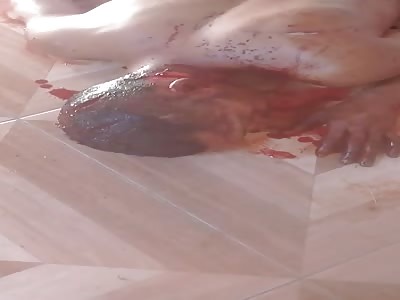 Man agonizing after stabbed