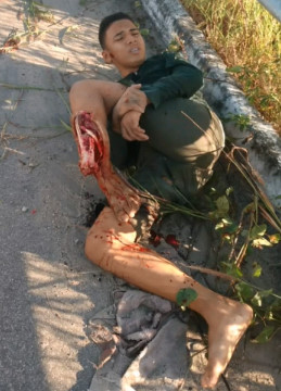 Never Gonna Ride his Bike Again